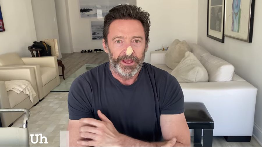Aktor Australia Hugh Jackman mengungkapkan bahwa dia menjalani lebih banyak tes kanker kulit. (Tangkapan Layar Instagram @ thehughjackman)