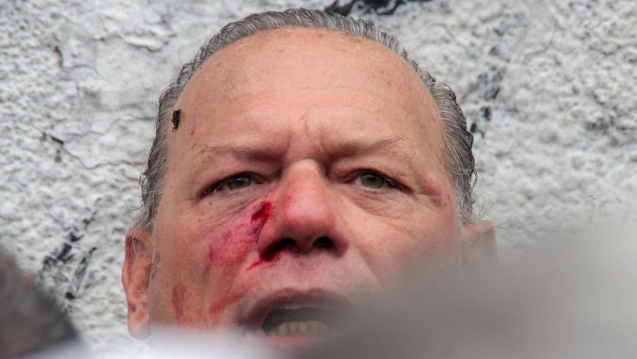 Menteri Keamanan provinsi Buenos Aires, Sergio Berni dilindungi oleh polisi dilindungi setelah dipukuli oleh sekelompok pengemudi bus yang memprotes pembunuhan seorang rekannya di La Matanza, Buenos Aires, (3/4/2023). (AFP via Getty Images/ANDRES PELOZO)