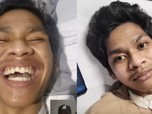 Pengobatan David Tembus Rp1,2 M, Ini Cedera yang Dialami