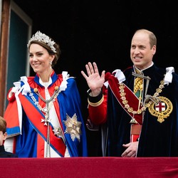 Kate Middleton Jalani Operasi Serius, Harus Cuti Tiga Bulan