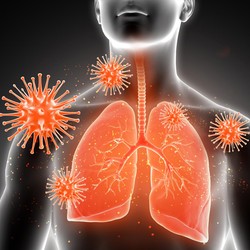 Anak-Anak Rentan Diserang Pneumonia, Ini Penjelasan Dokter Anak