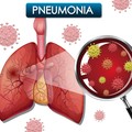 Ibu Hamil Pengidap Pneumonia Bisa Menularkan ke Janin? Ini Kata Dokter