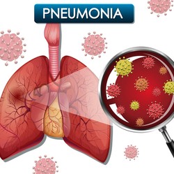 Ibu Hamil Pengidap Pneumonia Bisa Menularkan ke Janin? Ini Kata Dokter