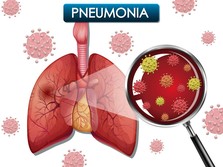 Awas Mendadak Mati Gegara Flu, Cegah dengan Cara Mudah Ini