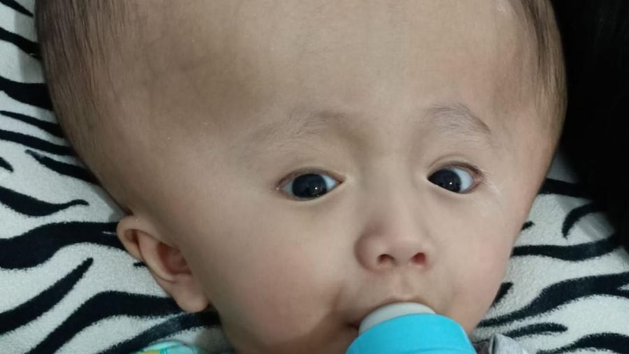 Radhitya Bagas Saputra atau yang biasanya dipanggil Bagas (3), divonis oleh dokter bahwa ia mengidap hidrosefalus saat usia janinnya masih menuju 9 bulan. (Dok. Berbuat Baik)