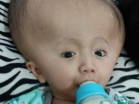 Jatuh Bangun Kuli Panggul Kayu Sembuhkan Anak Hidrosefalus