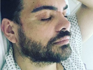 Pria Ini Nekat Injeksi Oli ke Wajah Demi Mirip Ricky Martin, Begini Nasibnya