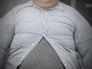 Obesitas Rentan Terjadi di Perkotaan, Kemenkes RI Ungkap Kebiasaan yang Jadi Pemicunya