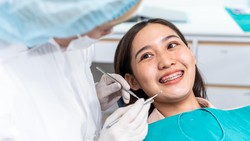 Jadi Sering Iyup saat Pakai Behel? Ini yang Sebenarnya Terjadi
