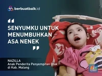Senyum Tegar Nazila, Bocah Yatim Piatu Alami Penyempitan Otak