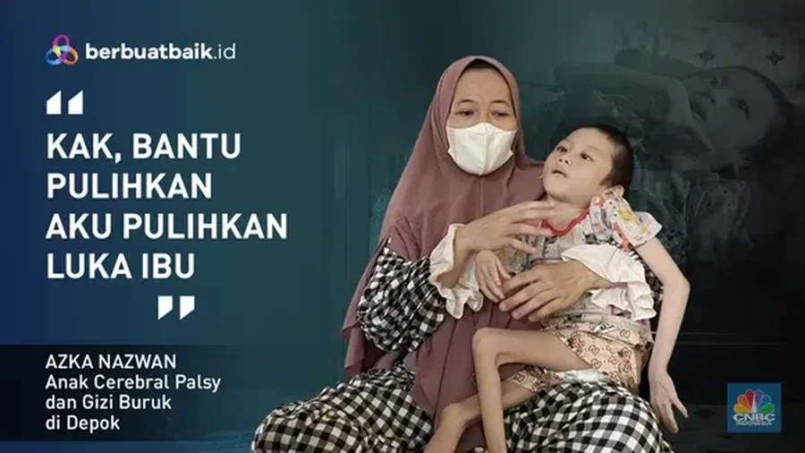 Kisah Pilu Azka, Alami Cerebral Palsy hingga Tinggal Tulang Berbungkus Kulit. (Dok. barbuatbaik.id)