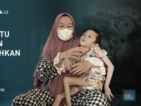 Kisah Azka, Alami Cerebral Palsy dan Tulang Berbungkus Kulit