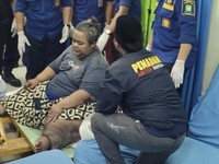Lagi! Pasien Obesitas 200 Kg Meninggal di RSCM, Ini Sebabnya