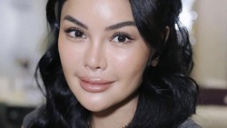 Nikita Mirzani Laporkan VA Usai Curhat