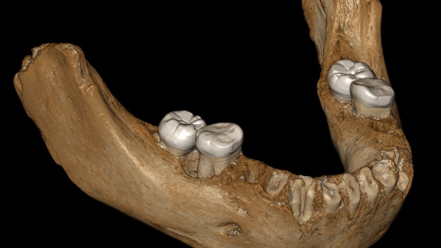 Rekonstruksi fosil manusia purba Xiahe, yang dikelompokkan sebagai Denisovan.