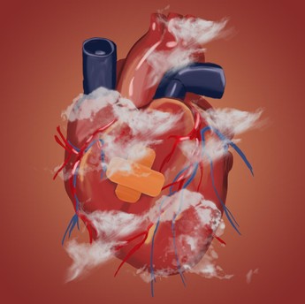 4 Jenis Penyakit Jantung Ini Bisa Muncul Gegara Polusi Udara