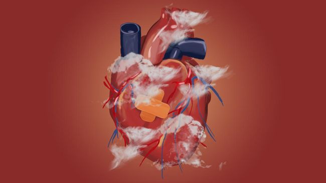 Dokter Ungkap Anak Muda Mulai Kena Penyakit Jantung, Begini Alasannya