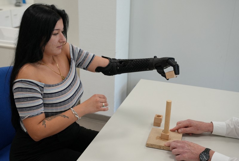 Lengan bionik cetak 3D pertama yang disetujui secara medis di dunia.  (REUTERS/Max Schwarz)