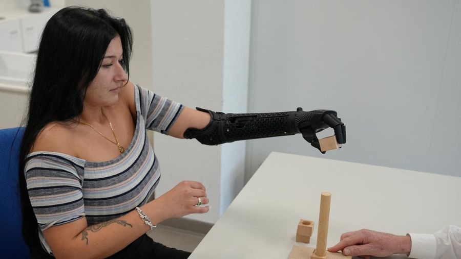Lengan bionik cetak 3D pertama yang disetujui secara medis di dunia.  (REUTERS/Max Schwarz)