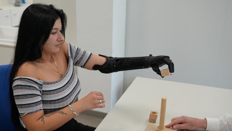 Lengan bionik cetak 3D pertama yang disetujui secara medis di dunia.  (REUTERS/Max Schwarz)