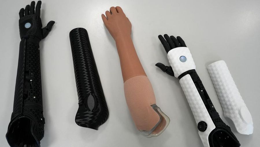 Lengan bionik cetak 3D pertama yang disetujui secara medis di dunia.  (REUTERS/Max Schwarz)