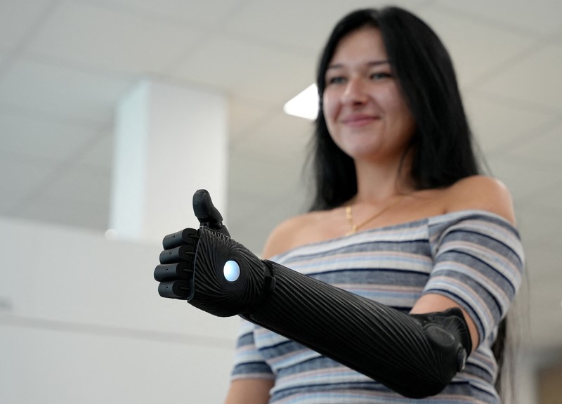 Lengan bionik cetak 3D pertama yang disetujui secara medis di dunia. (REUTERS/Max Schwarz) Lengan bionik cetak 3D pertama yang disetujui secara medis di dunia. (REUTERS/Max Schwarz)