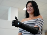 Wow! Ini Penampakan Lengan Bionik Cetak 3D Pertama di Dunia