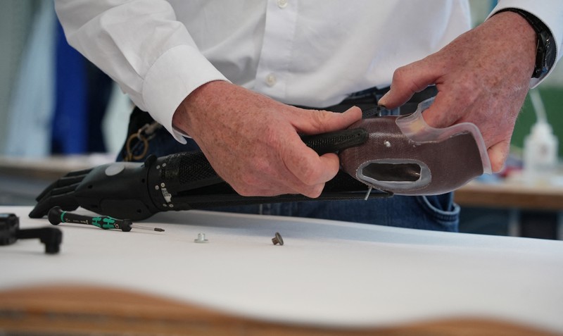 Lengan bionik cetak 3D pertama yang disetujui secara medis di dunia. (REUTERS/Max Schwarz) Lengan bionik cetak 3D pertama yang disetujui secara medis di dunia. (REUTERS/Max Schwarz)