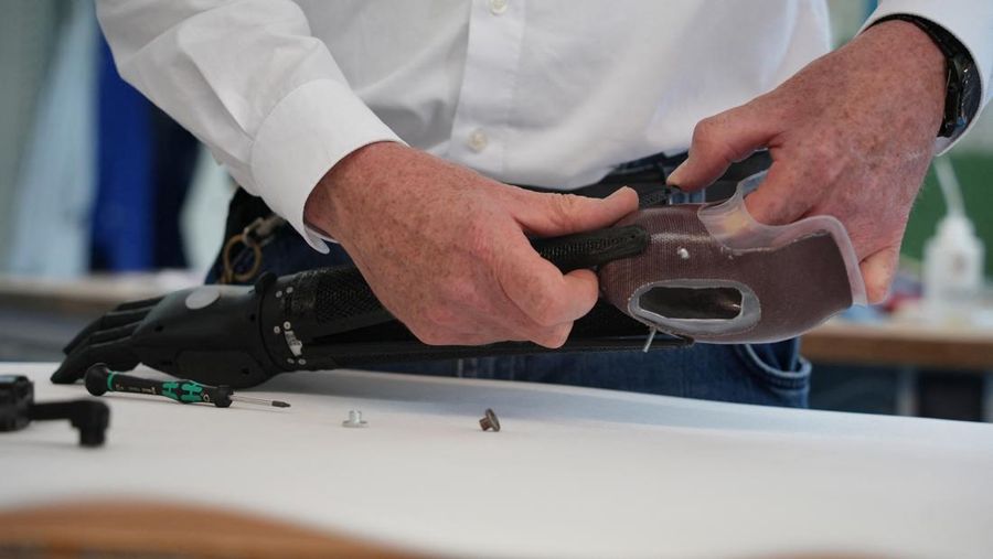 Lengan bionik cetak 3D pertama yang disetujui secara medis di dunia.  (REUTERS/Max Schwarz)