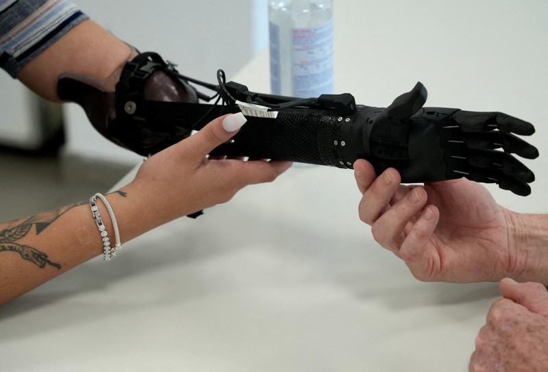 Lengan bionik cetak 3D pertama yang disetujui secara medis di dunia. (REUTERS/Max Schwarz) Lengan bionik cetak 3D pertama yang disetujui secara medis di dunia. (REUTERS/Max Schwarz)