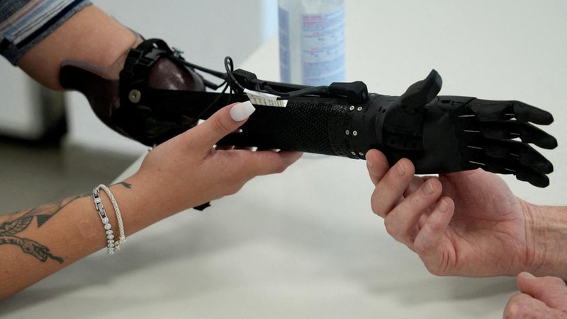 Lengan bionik cetak 3D pertama yang disetujui secara medis di dunia.  (REUTERS/Max Schwarz)