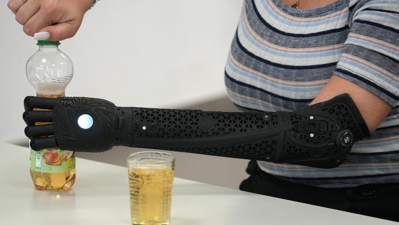 Lengan bionik cetak 3D pertama yang disetujui secara medis di dunia.  (REUTERS/Max Schwarz)