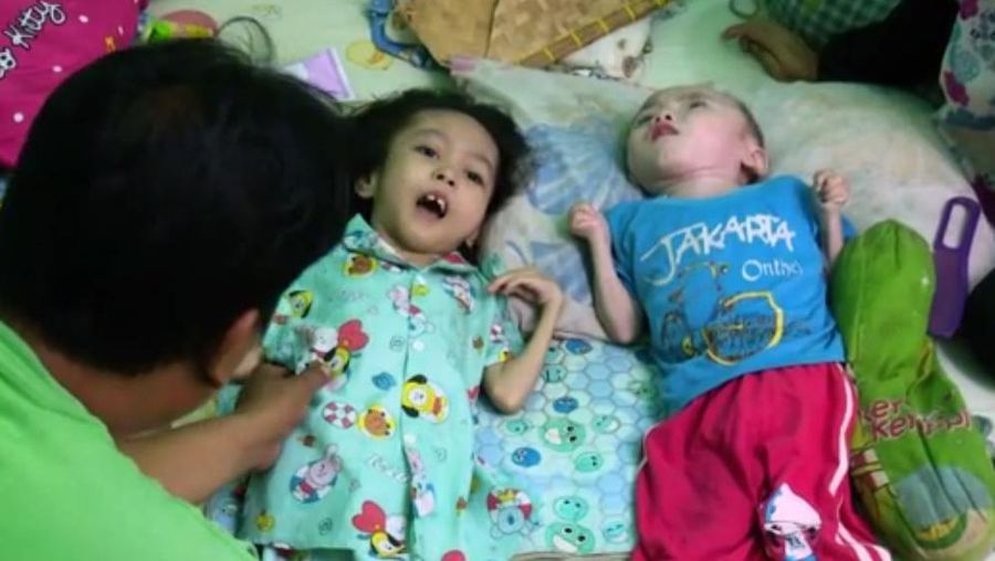Nasib Malang 2 Anak Buruh Harian Pasar Alami Penyakit Lumpuh Otak. (Dok. Berbuat Baik.id)