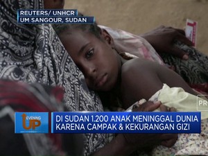 1.200 Anak di Sudan Meninggal Dunia Karena Campak