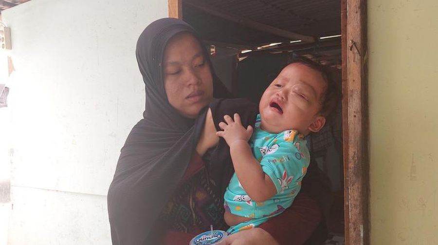 Arumi Nashya Rezita, balita berusia 14 bulan ini harus berjuang dan hanya bisa menangis menahan rasa sakit karena tumor mata yang menyerang mata kirinya. (Dok. Berbuat Baik)