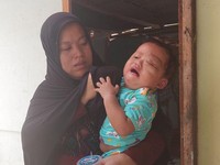 Derita & Tangis Anak Penjual Bihun Gulung Pengidap Tumor Mata