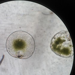 Virus Mengerikan Serang Anak Kecil, Ilmuwan Beberkan Gejalanya