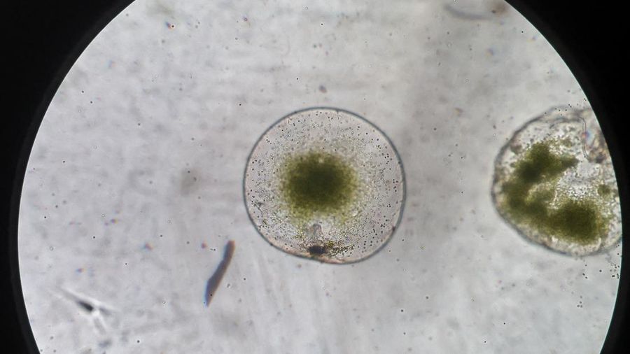 Phytoplankton Noctiluca Scintillans is seen through a microscope, at a lab in Chonburi province, Thailand, September 14, 2023. REUTERS/Athit Perawongmetha