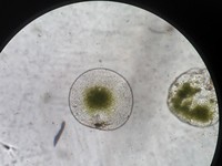 Virus Mengerikan Serang Anak Kecil, Ilmuwan Beberkan Gejalanya