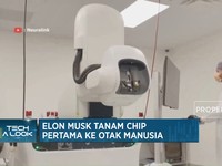 Video: Elon Musk Tanam Chip Pertama Ke Otak Manusia