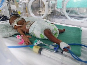 Nasib Bayi-bayi Warga Palestina di RS Al Shifa, Tewas Akibat Kepungan Israel