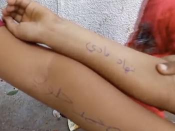 Bisa Mati Kapan Saja, Warga Gaza Bergelang Biru-Nama di Badan