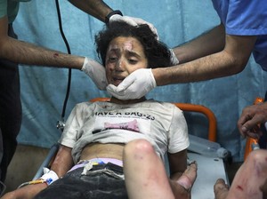 Kesaksian Pilu Perawat Lihat Momen Operasi Pasien di Gaza Tanpa Anestesi