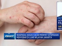Cegah Cacar Monyet Meluas, Kemenkes Siapkan Obat & Vaksinasi