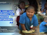 Tanpa Kaki Tangan Sempurna, Anak Pembuat Kusen Hidup Tegar