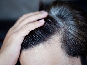 Viral Tren Suntik Obat Uban di China, Rambut Putih Diklaim Bisa Kembali Hitam