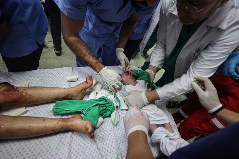 Banyak petugas kesehatan di Palestina yang mengalami trauma, frustrasi, dan kelelahan yang luar biasa alias burnout imbas menangani ribuan korban serangan Israel. (Photo by Abed Zagout/Anadolu via Getty Images)