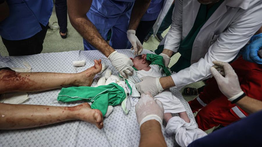 Banyak petugas kesehatan di Palestina yang mengalami trauma, frustrasi, dan kelelahan yang luar biasa alias burnout imbas menangani ribuan korban serangan Israel. (Photo by Abed Zagout/Anadolu via Getty Images)