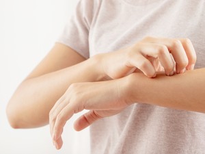 3 Rekomendasi Obat Alergi Gatal yang Umum Dibeli di Apotek