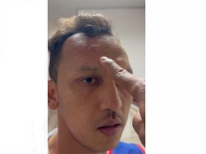 Kapten PSMS Diduga Dipukul Wapres Persiraja, Kepalanya Benjol